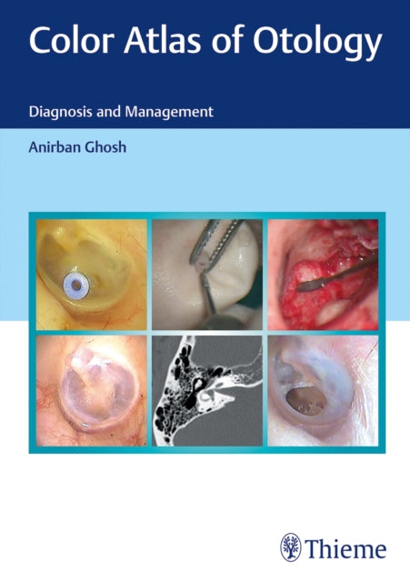 Color Atlas of Otology: Diagnosis and Management