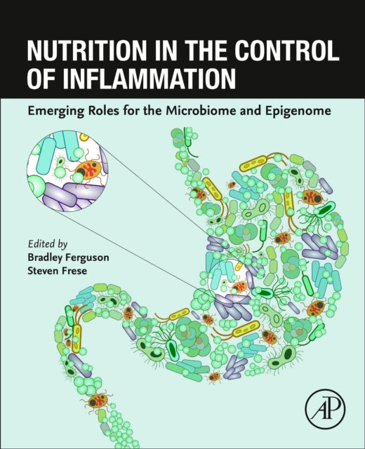 Nutrition in the Control of Inflammation: Emerging Roles for the Microbiome and Epigenome