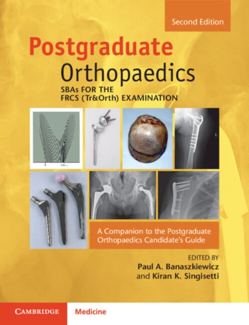 SBAs for the FRCS (Tr&Orth) Examination: A Companion to the Postgraduate Orthopaedics Candidate's Guide