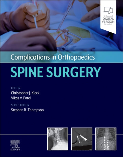 Complications in Orthopaedics: Spine Surgery