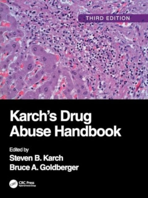Karch's Drug Abuse Handbook