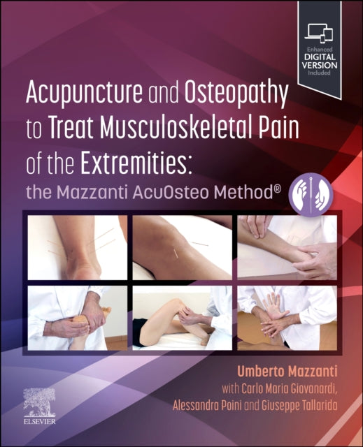 Acupuncture and Osteopathy to Treat Musculoskeletal Pain of the Extremities: the Mazzanti AcuOsteo Method®