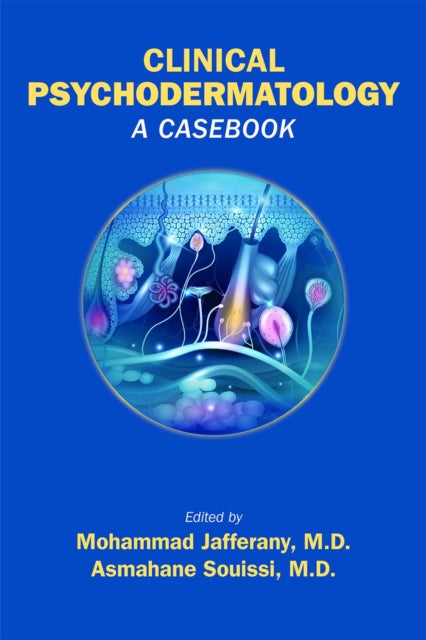 Clinical Psychodermatology: A Casebook