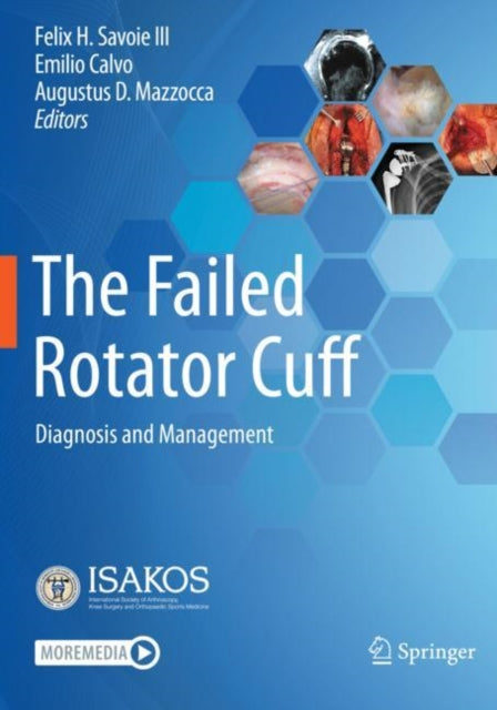 The Failed Rotator Cuff: Diagnosis and Management
