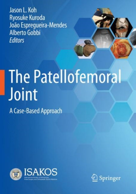 The Patellofemoral Joint: A Case-Based Approach