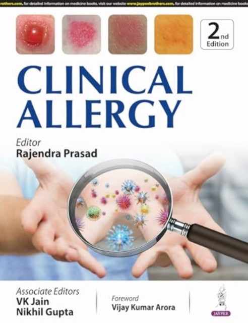 Clinical Allergy