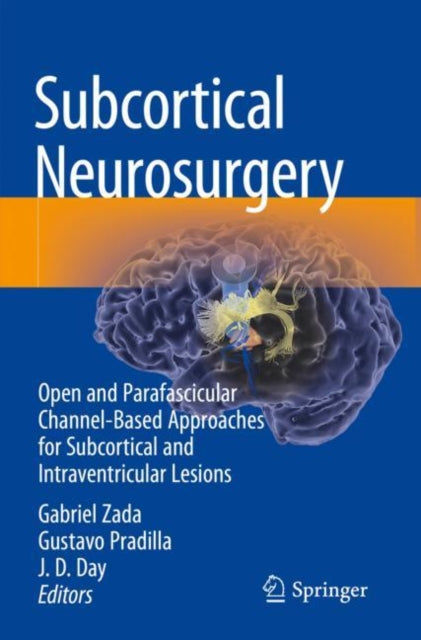 Subcortical Neurosurgery: Open and Parafascicular Channel-Based Approaches for Subcortical and Intraventricular Lesions