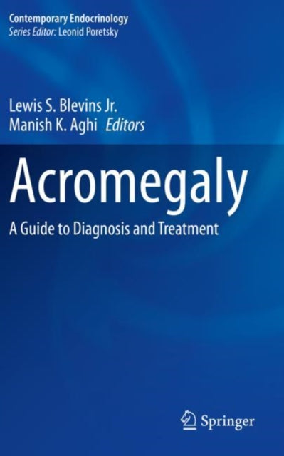 Acromegaly: A Guide to Diagnosis and Treatment