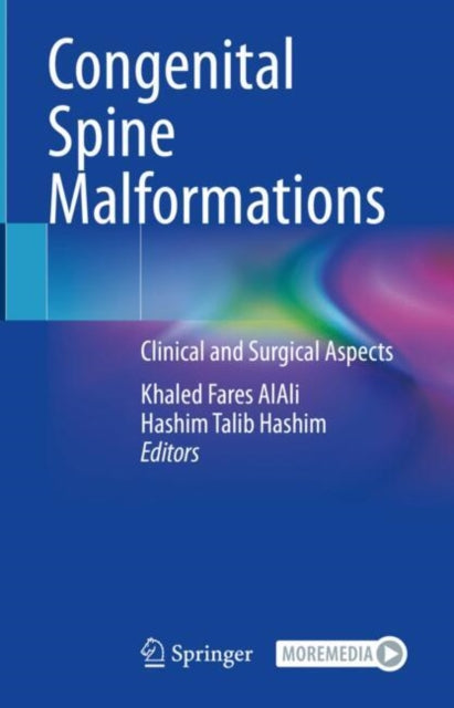 Congenital Spine Malformations: Clinical and Surgical Aspects