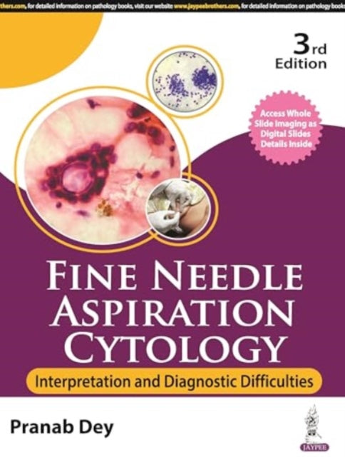 Fine Needle Aspiration Cytology: Interpretation and Diagnostic Difficulties