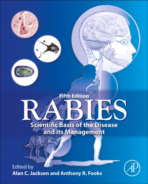 Rabies: Scientific Basis of the Disease and Its Management