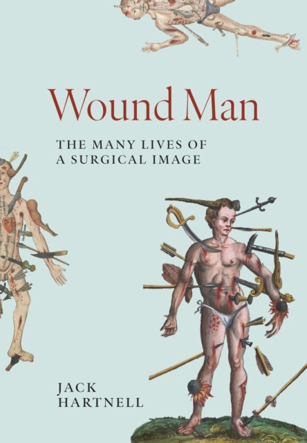 Wound Man: The Many Lives of a Surgical Image
