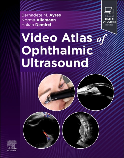 Video Atlas of Ophthalmic Ultrasound
