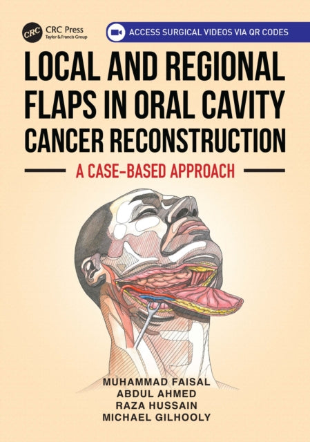 Local and Regional Flaps in Oral Cavity Cancer Reconstruction: A case-based approach