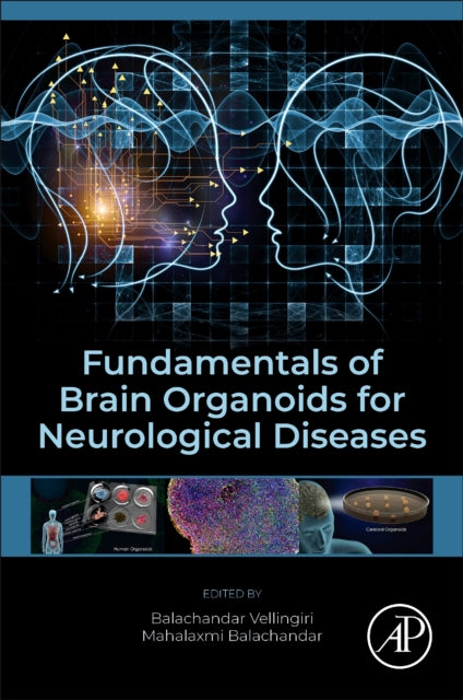 Fundamentals of Brain Organoids for Neurological Diseases