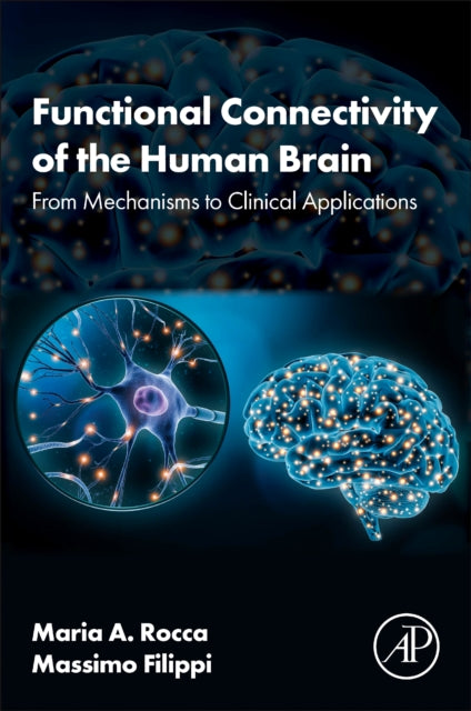 Functional Connectivity of the Human Brain: From Mechanisms to Clinical Applications