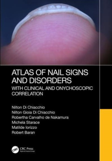 Atlas of Nail Signs and Disorders with Clinical and Onychoscopic Correlation