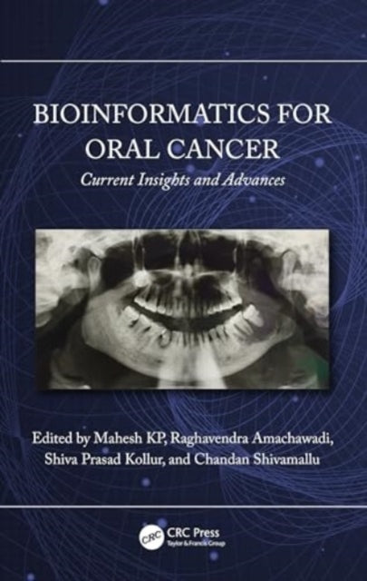 Bioinformatics for Oral Cancer: Current Insights and Advances