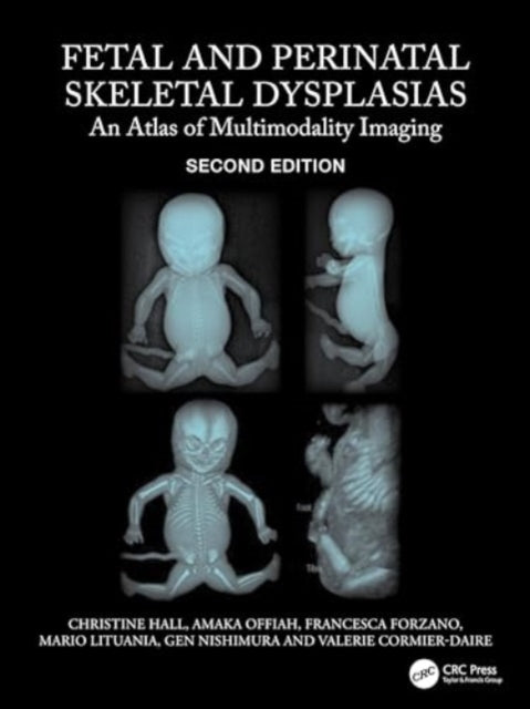 Fetal and Perinatal Skeletal Dysplasias: An Atlas of Multimodality Imaging
