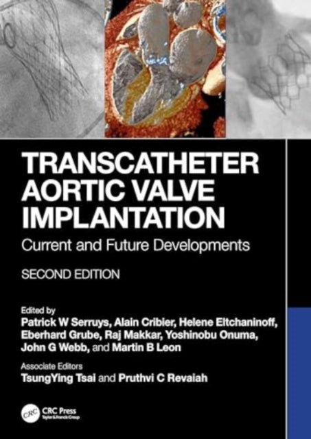 Transcatheter Aortic Valve Implantation: Current and Future Developments