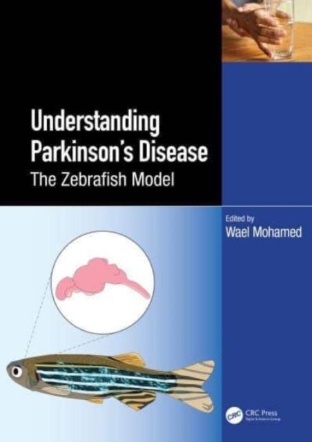 Zebrafish as a Model for Parkinson’s Disease
