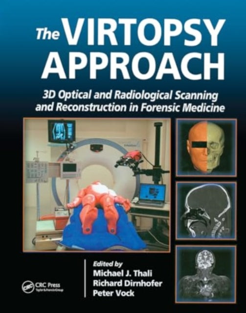 The Virtopsy Approach: 3D Optical and Radiological Scanning and Reconstruction in Forensic Medicine