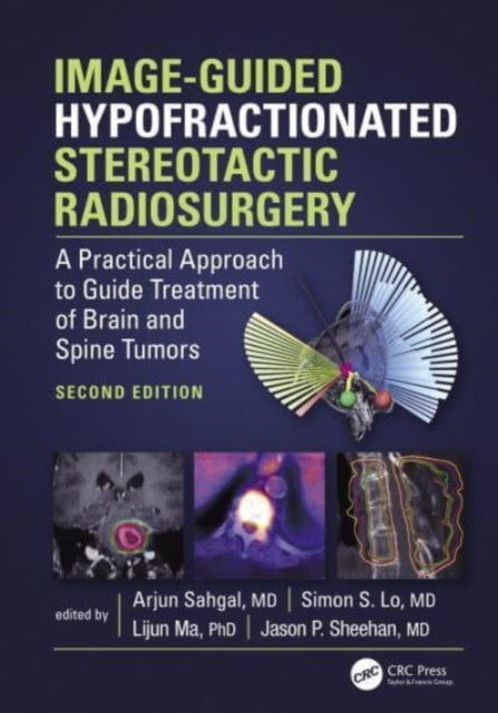 Image-Guided Hypofractionated Stereotactic Radiosurgery: A Practical Approach to Guide Treatment of Brain and Spine Tumors