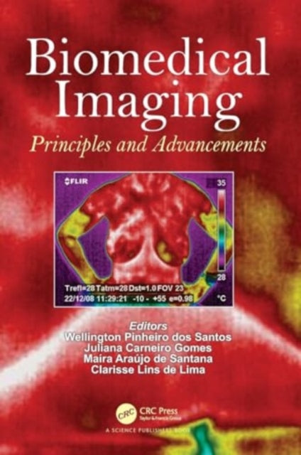 Biomedical Imaging: Principles and Advancements