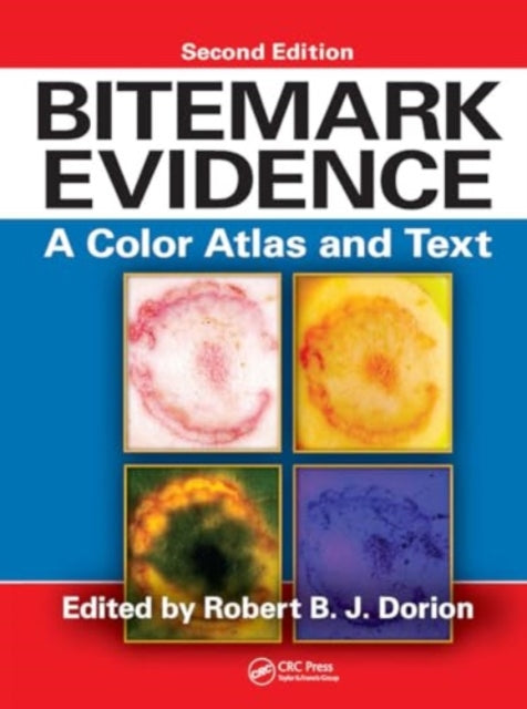 Bitemark Evidence: A Color Atlas and Text, 2nd Edition