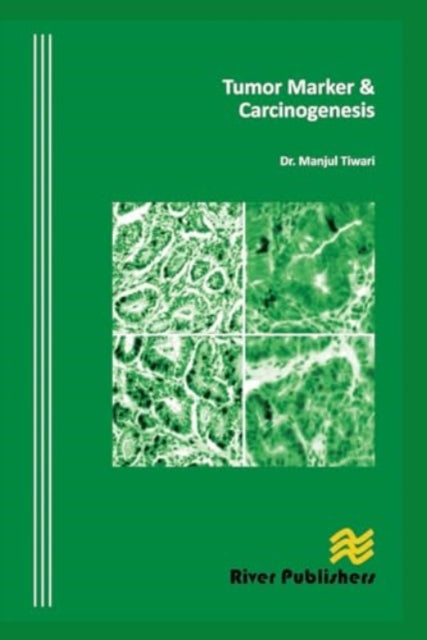 Tumor Marker and Carcinogenesis