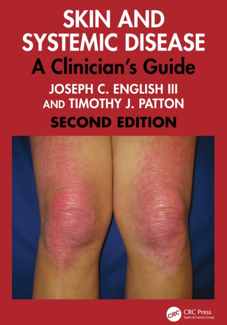 Skin and Systemic Disease: A Clinician's Guide