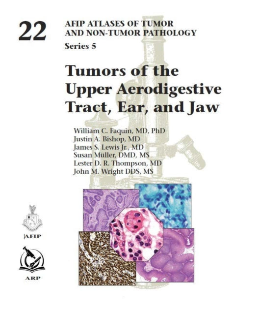 Tumors of the Upper Aerodigestive Tract, Ear, and Jaw