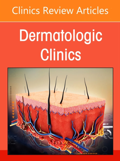 Artificial Intelligence in Dermatology, An Issue of Dermatologic Clinics