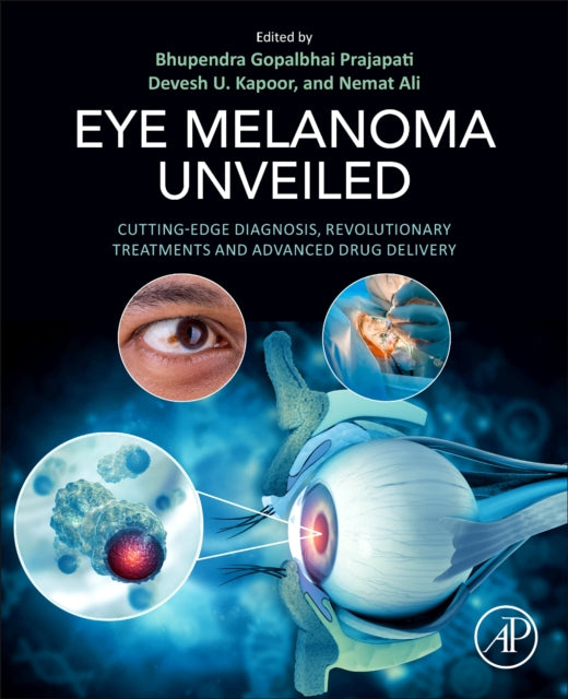 Eye Melanoma Unveiled: Cutting-Edge Diagnosis, Revolutionary Treatments and Advanced Drug Delivery