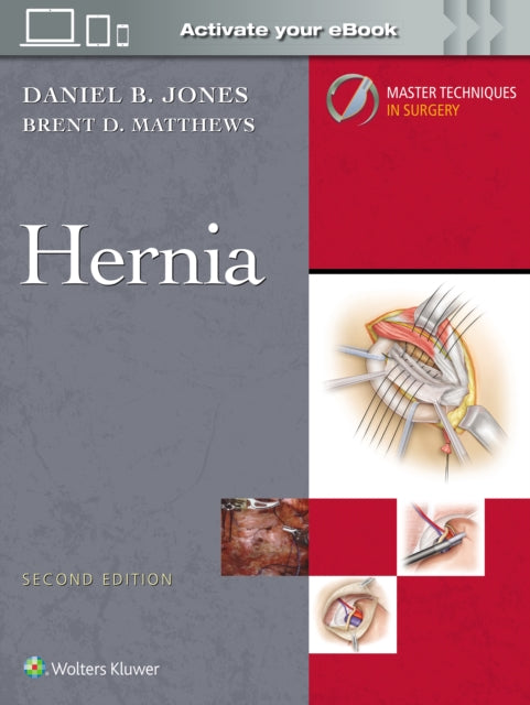 Master Techniques in Surgery: Hernia: Print + eBook with Multimedia