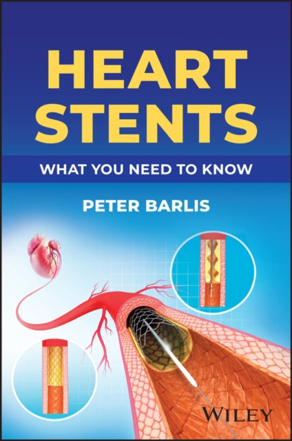 Heart Stents: What You Need to Know