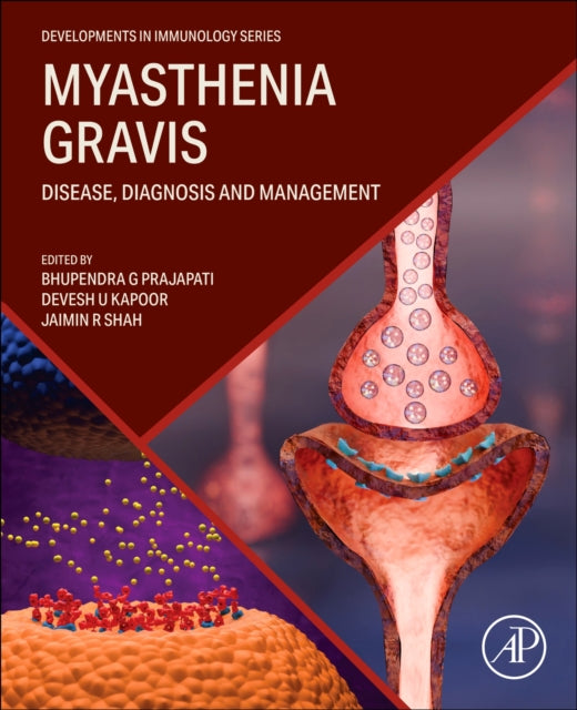 Myasthenia Gravis: Disease, Diagnosis and Management