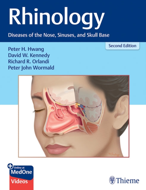 Rhinology: Diseases of the Nose, Sinuses, and Skull Base