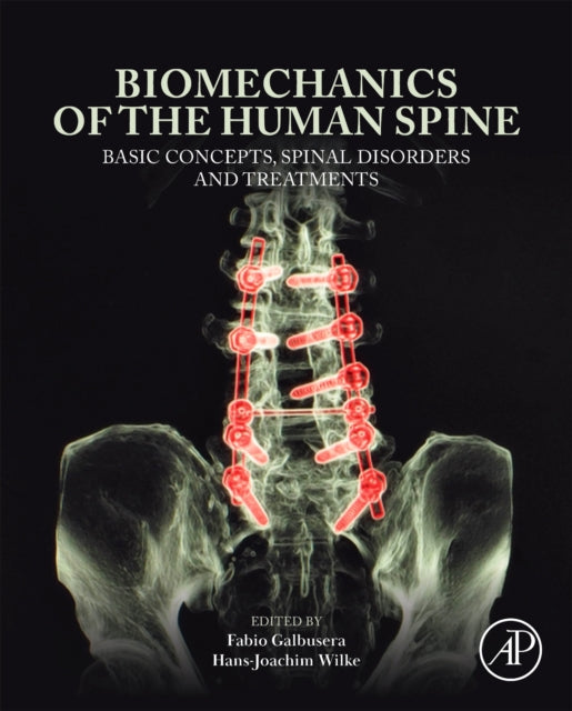 Biomechanics of the Human Spine: Basic Concepts, Spinal Disorders and Treatments