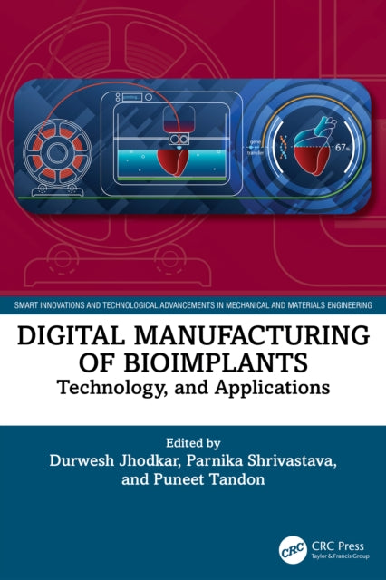 Digital Manufacturing of Bioimplants: Technology and Applications