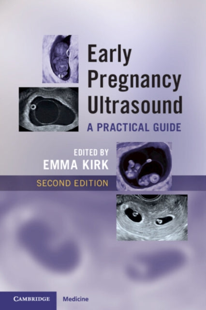 Early Pregnancy Ultrasound: A Practical Guide
