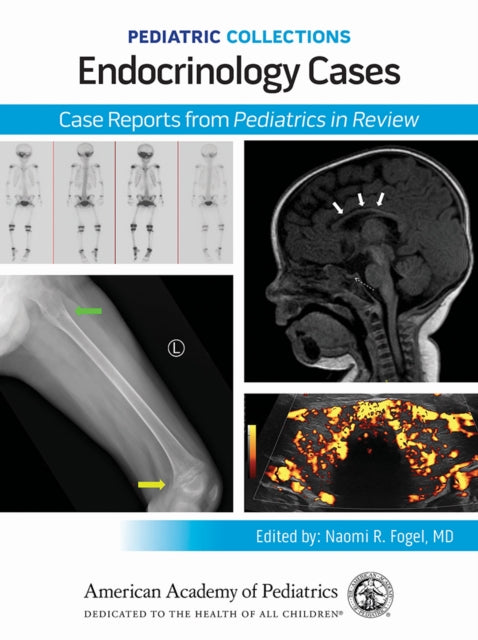Endocrinology Cases: Case Reports from Pediatrics in Review