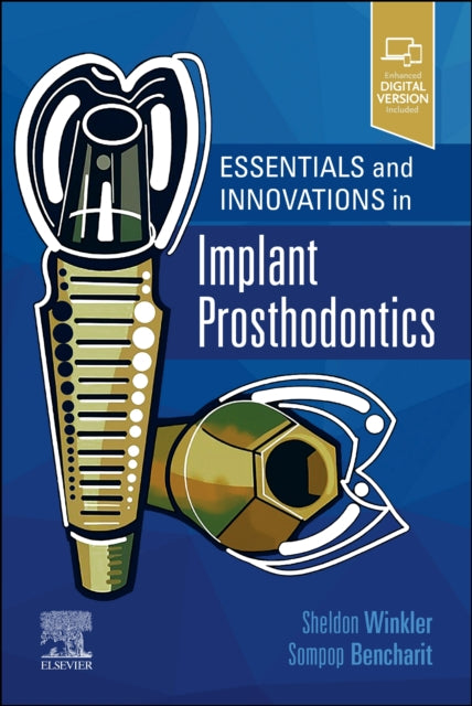 Essentials and Innovations in Implant Prosthodontics