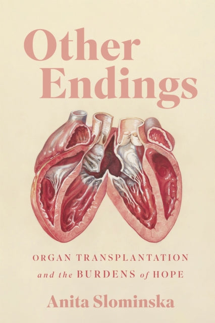 Other Endings: Organ Transplantation and the Burdens of Hope