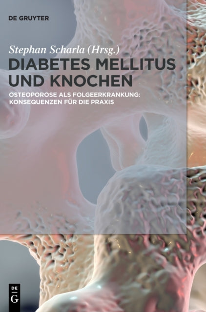 Diabetes Mellitus und Knochen: Osteoporose als Folgeerkrankung: Konsequenzen fur die Praxis