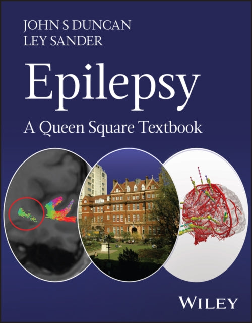 Epilepsy: A Queen Square Textbook