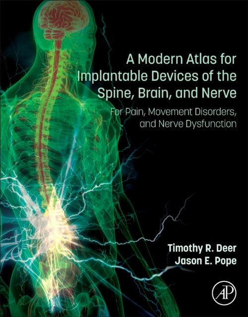 A Modern Atlas for Implantable Devices of the Spine, Brain, and Nerve: For Pain, Movement Disorders, and Nerve Dysfunction