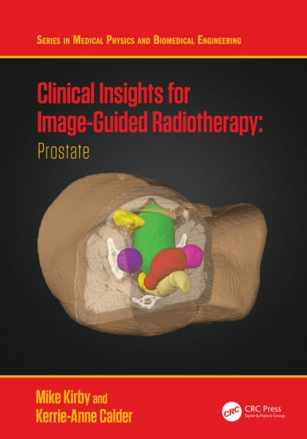 Clinical Insights for Image-Guidance Radiation Therapy: Prostate