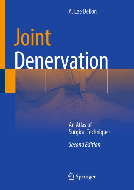 Joint Denervation: An Atlas of Surgical Techniques