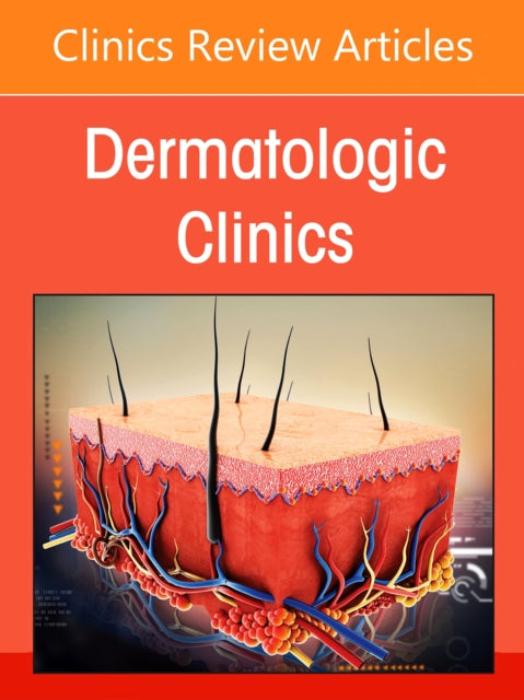 Medical Devices in Dermatology, An Issue of Dermatologic Clinics
